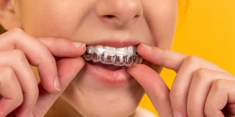 Achieving Your Perfect Smile: Ideal Orthodontics & Invisalign Solutions