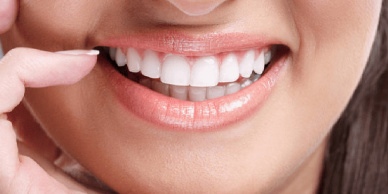 A Captivating Smile Awaits You at Smart Smile Dental Clinic in Dubai